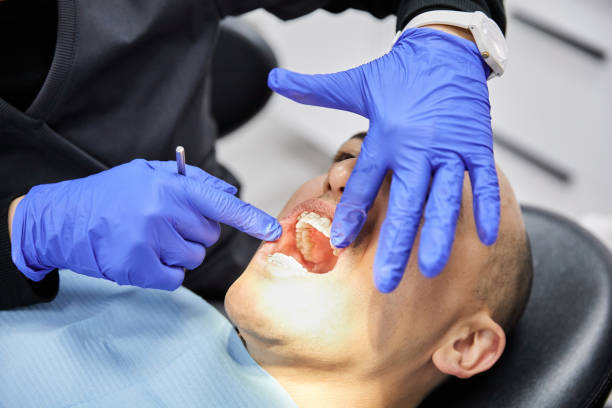 Fast & Reliable Emergency Dental Services in MD